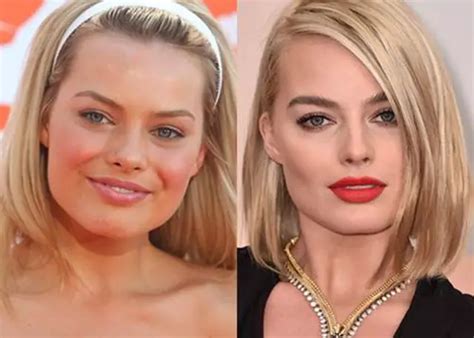 Margot Robbie Before and After Plastic Surgery